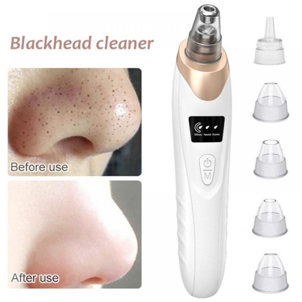Electric Blackhead Remover – Deep Pore Cleaning Device