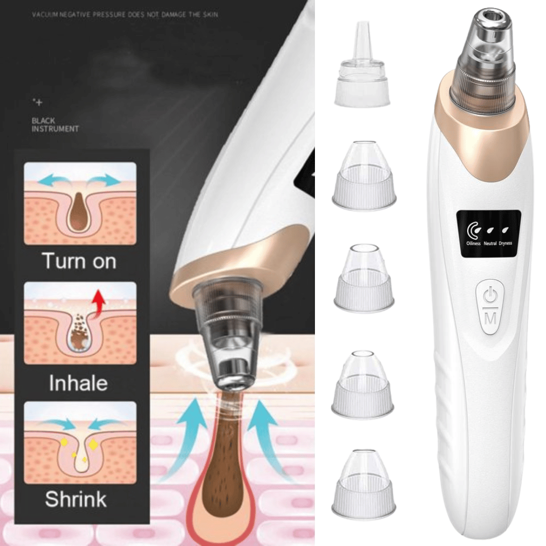 Electric Blackhead Remover – Deep Pore Cleaning Device