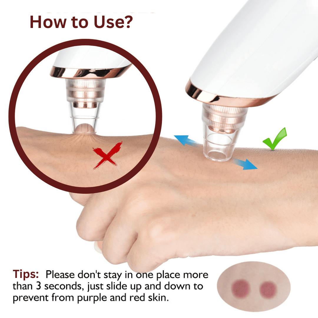 Electric Blackhead Remover – Deep Pore Cleaning Device